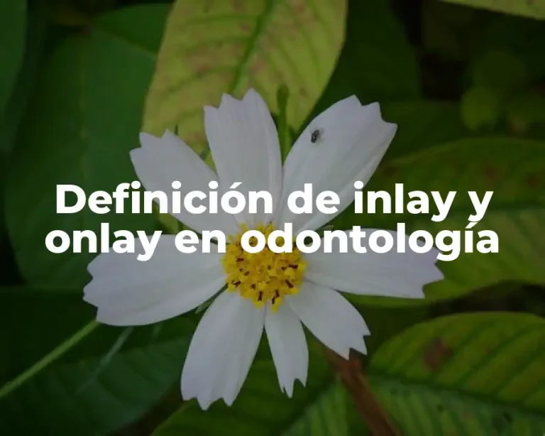 Definición de inlay y onlay en odontología