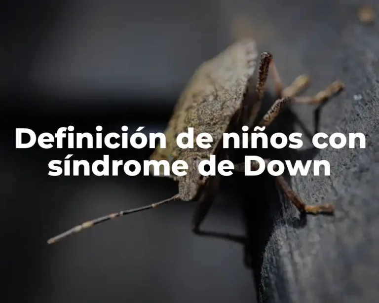 Definición de niños con síndrome de Down