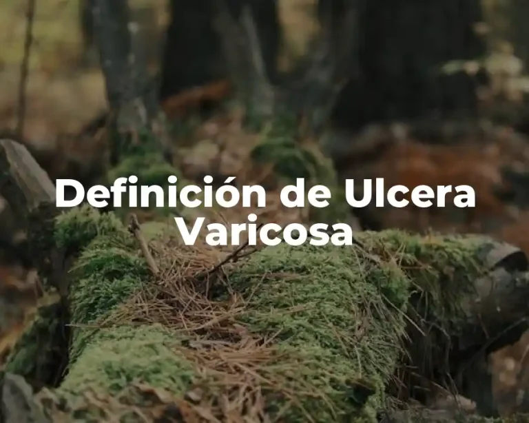 Definición de Ulcera Varicosa