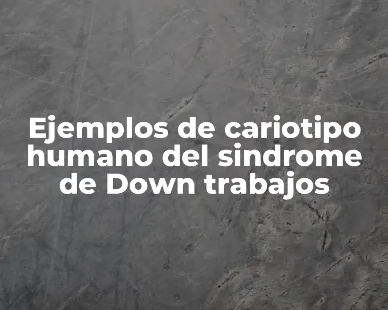 Ejemplos de cariotipo humano del sindrome de Down trabajos