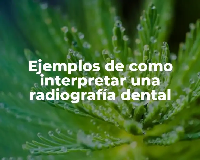 Ejemplos de como interpretar una radiografía dental