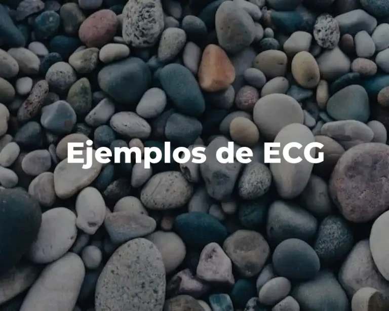 Ejemplos de ECG
