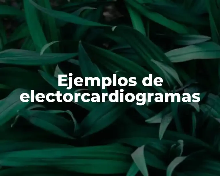 Ejemplos de electorcardiogramas