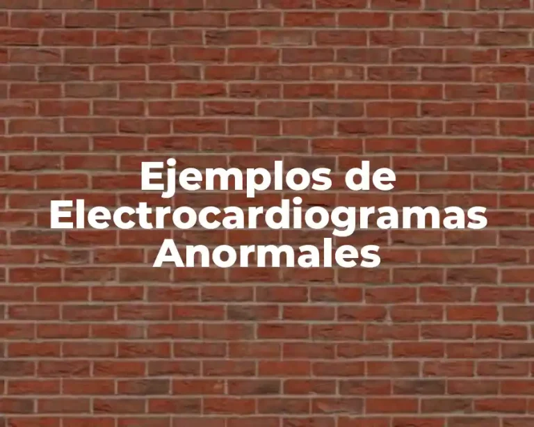 Ejemplos de Electrocardiogramas Anormales