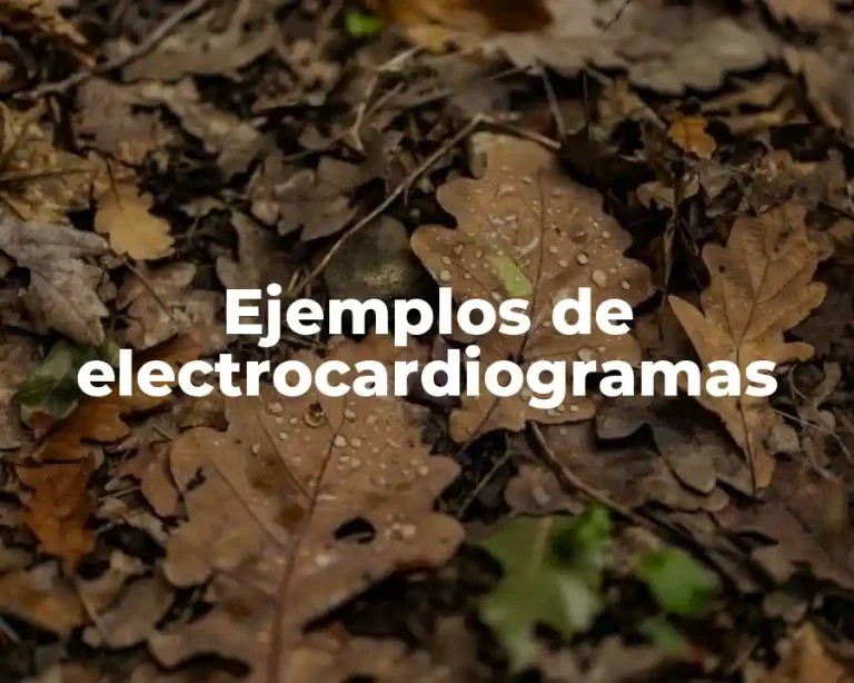Ejemplos de electrocardiogramas