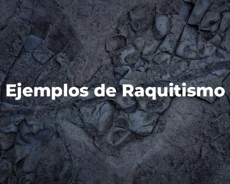 Ejemplos de Raquitismo