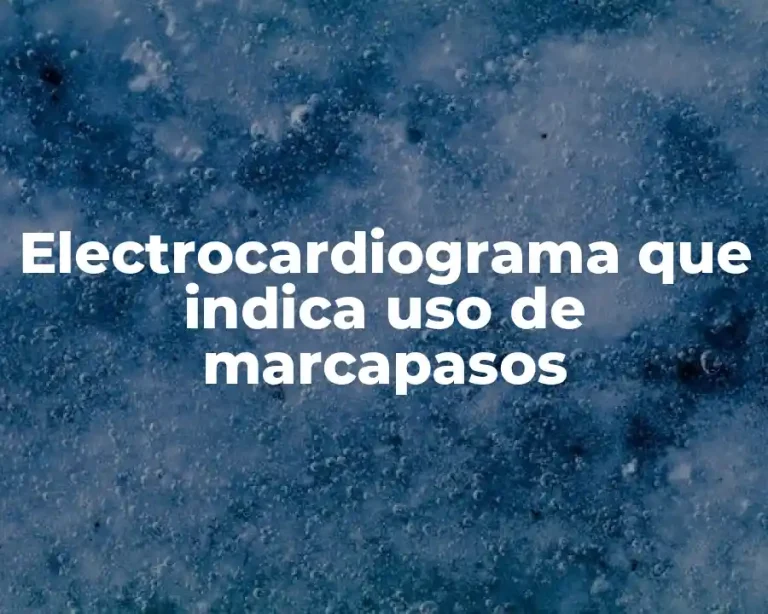 Electrocardiograma que indica uso de marcapasos