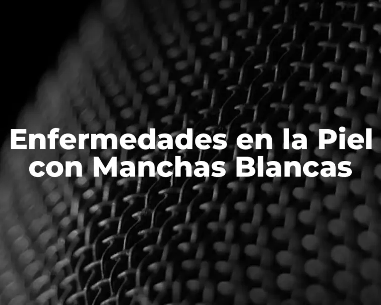Enfermedades en la Piel con Manchas Blancas