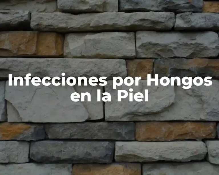 Infecciones por Hongos en la Piel