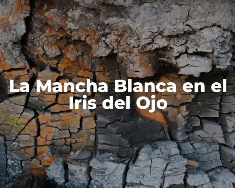 La Mancha Blanca en el Iris del Ojo