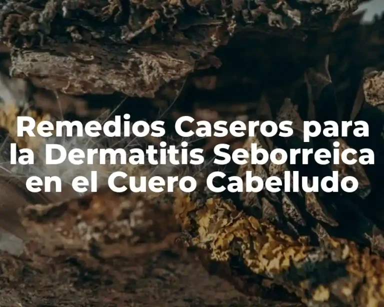 Remedios Caseros para la Dermatitis Seborreica en el Cuero Cabelludo