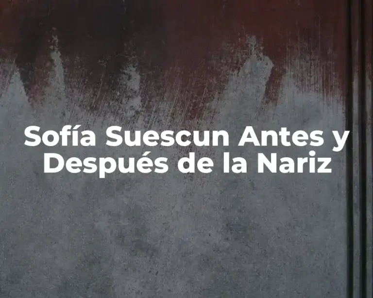 Sofía Suescun Antes y Después de la Nariz