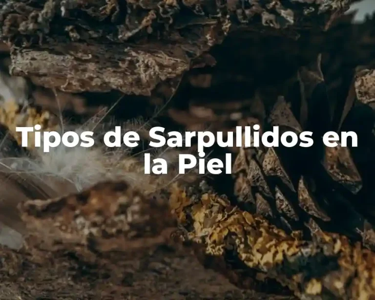 Tipos de Sarpullidos en la Piel